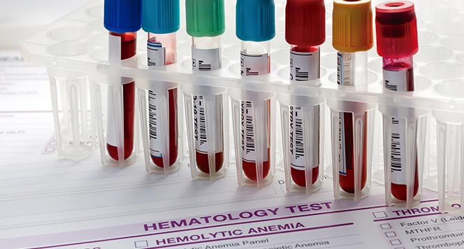 Marshall Hematology